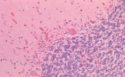 Neuritin Antibody, Novus Biologicals 50 &mu;g | Buy Online | Novus Biologicals | Fisher Scientific